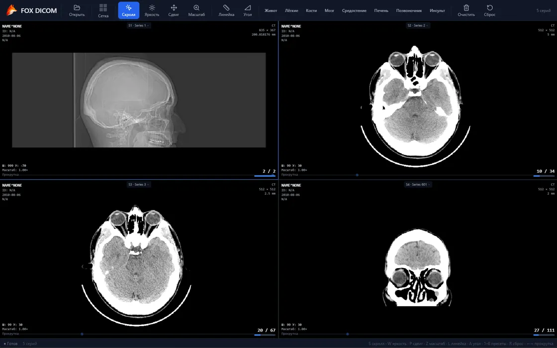 DICOM Viewer