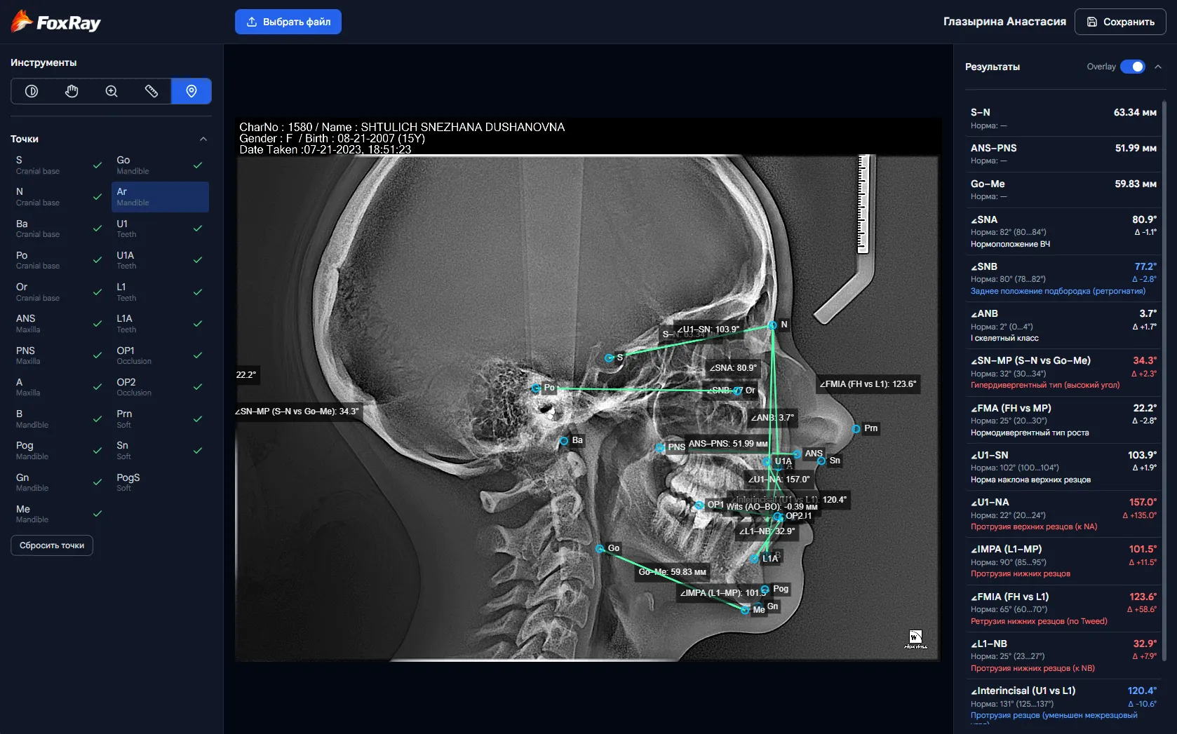 FoxRay. Расчет боковой ТРГ. Стоматологический инструмент